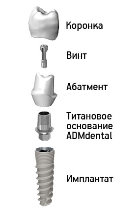 Абатмент на имплант