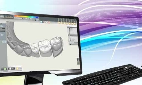 Cad cam технологии в ортопедической стоматологии презентация